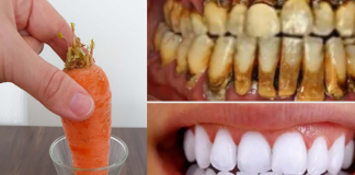 Teeth whitening in just 2 minutes – turning yellow and accumulated tartar into milk-like white and shiny.