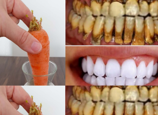 Teeth whitening in just 2 minutes – turning yellow and accumulated tartar into milk-like white and shiny.