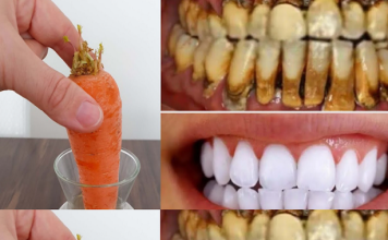 Teeth whitening in just 2 minutes – turning yellow and accumulated tartar into milk-like white and shiny.