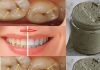 Homemade toothpaste that whitens teeth, treats cavities and gum disease