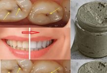 Homemade toothpaste that whitens teeth, treats cavities and gum disease