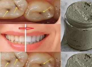 Homemade toothpaste that whitens teeth, treats cavities and gum disease