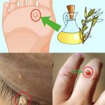Get Rid Of Skin Problems Naturally