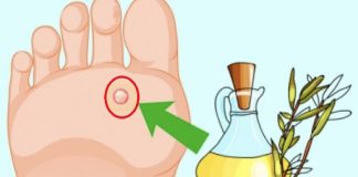 Get Rid Of Skin Problems Naturally