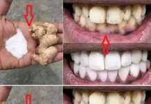 Bright Smile, Brighter Confidence: A Homemade Teeth Whitening Solution