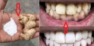 Bright Smile, Brighter Confidence: A Homemade Teeth Whitening Solution