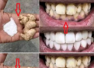 Bright Smile, Brighter Confidence: A Homemade Teeth Whitening Solution