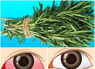 Nurturing Your Eyes: The Natural Path to Optimal Vision