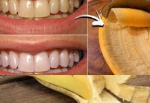 A Brighter Smile with a Simple Secret: The Banana Peel Trick