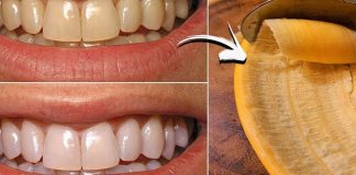 A Brighter Smile with a Simple Secret: The Banana Peel Trick