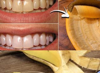 A Brighter Smile with a Simple Secret: The Banana Peel Trick