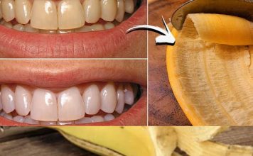 A Brighter Smile with a Simple Secret: The Banana Peel Trick