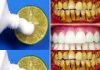 Brighten Your Smile Naturally: The Two-Minute Lemon Whitening Method