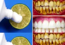 Brighten Your Smile Naturally: The Two-Minute Lemon Whitening Method