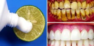 Brighten Your Smile Naturally: The Two-Minute Lemon Whitening Method
