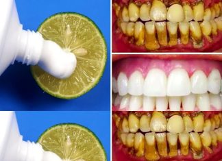 Brighten Your Smile Naturally: The Two-Minute Lemon Whitening Method