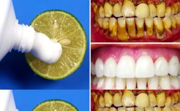 Brighten Your Smile Naturally: The Two-Minute Lemon Whitening Method