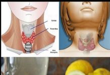 The mixture of ginger and lemon stimulates fat burning and provides vitamins and nutrients.