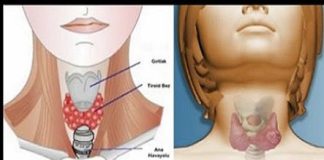 The mixture of ginger and lemon stimulates fat burning and provides vitamins and nutrients.