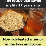 The recipe that saved my life 17 years ago: How I defeated a tumor in the liver and colon