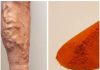 Wave Goodbye to Varicose Veins and Poor Circulation with Cayenne Pepper: The Natural Wonder