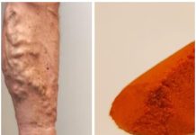 Wave Goodbye to Varicose Veins and Poor Circulation with Cayenne Pepper: The Natural Wonder
