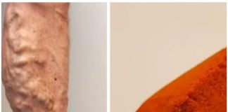 Wave Goodbye to Varicose Veins and Poor Circulation with Cayenne Pepper: The Natural Wonder