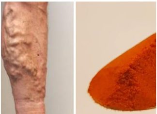 Wave Goodbye to Varicose Veins and Poor Circulation with Cayenne Pepper: The Natural Wonder