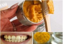 Learn about the natural wonder that turmeric may do for your dental health.