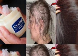Learn How to Make Your Own Hair Growth Balm and Uncover the Key to Long, Thick Hair!