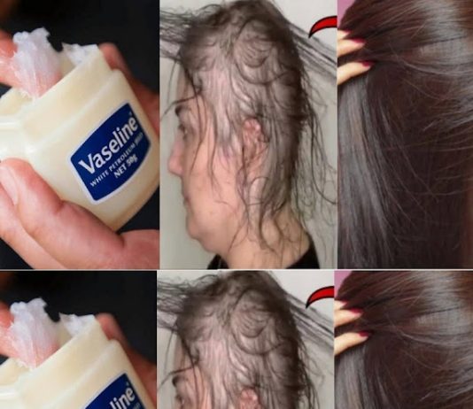 Learn How to Make Your Own Hair Growth Balm and Uncover the Key to Long, Thick Hair!