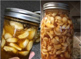 Fermented garlic in honey—a sweet and potent elixir with a safety tip
