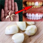 Unlock the Secret to a Brighter Smile with Garlic