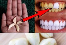 Unlock the Secret to a Brighter Smile with Garlic