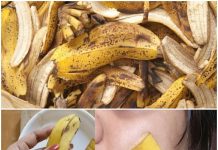Banana Peel Magic: Say Goodbye to Pimples with a DIY Banana Face Mask