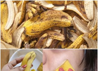 Banana Peel Magic: Say Goodbye to Pimples with a DIY Banana Face Mask