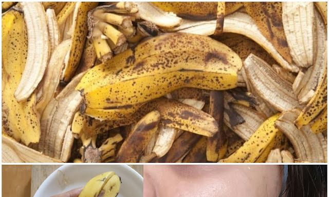 Banana Peel Magic: Say Goodbye to Pimples with a DIY Banana Face Mask