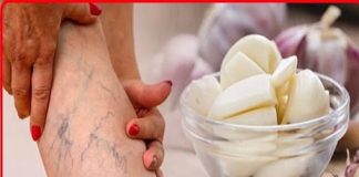 Leg pain, rheumatism, varicose veins, arthritis, headache, joint pain. Mother’s natural remedy.