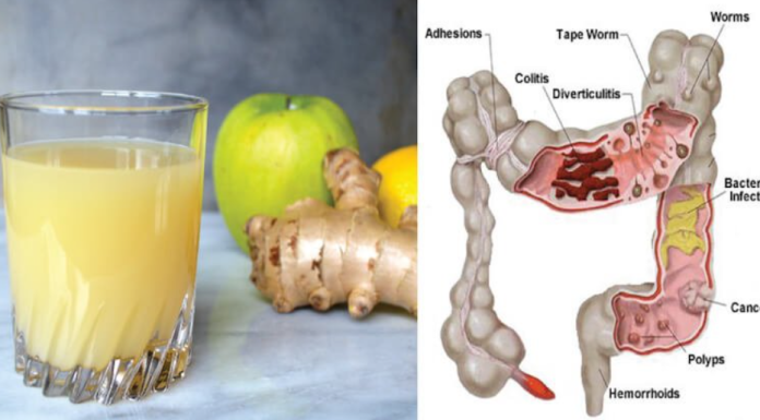 How Apple, Ginger & Lemon Can Flush Pounds of Toxins To Your Body