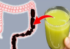 Lose Weight by Cleansing Your Colon? in 7 Days