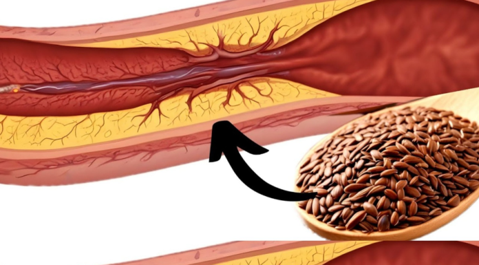 1 Tablespoon a Day: Flaxseed to Prevent Blood Clots, Heart Attacks, and Strokes!