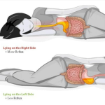 Discover the key to a more peaceful night’s rest by uncovering the benefits of sleeping on your left side.