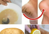 Natural Remedy for Cracked Heels: The Potato and Lemon Foot Mask