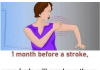 Stroke: These warning signs that appear 1 month before