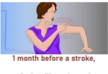 Stroke: These warning signs that appear 1 month before