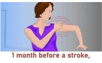 Stroke: These warning signs that appear 1 month before