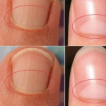 If You Don’t Have A Half Moon Shape On Your Nails, Visit A DOCTOR Immediately