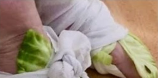 The Healing Power of Cabbage Wraps: A Natural Remedy for Swollen Joints and Thyroid Issues