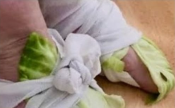 The Healing Power of Cabbage Wraps: A Natural Remedy for Swollen Joints and Thyroid Issues