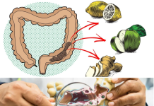 9 Home Remedies for Natural Colon Cleansing